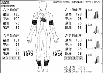 下肢動脈の狭窄・閉塞の評価図
