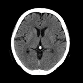 頭部（横断面）