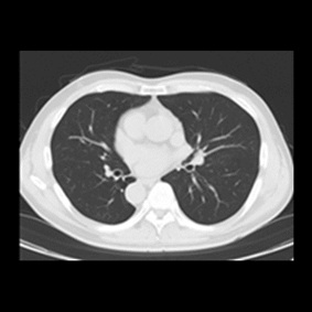 胸部（横断面）