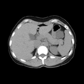 腹部（横断面）