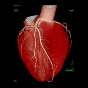  心臓（3D画像）